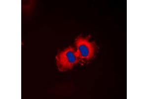 Immunofluorescent analysis of ALDH1A2 staining in HepG2 cells. (ALDH1A2 antibody  (C-Term))