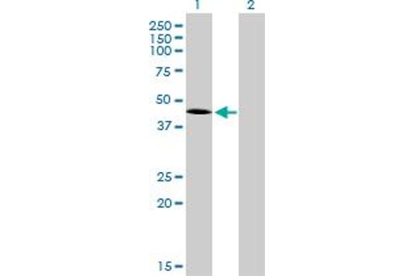 T Brachyury Protein (AA 222-320) antibody