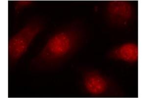 Image no. 3 for anti-Retinoblastoma 1 (RB1) (pSer780) antibody (ABIN196843) (Retinoblastoma 1 antibody  (pSer780))
