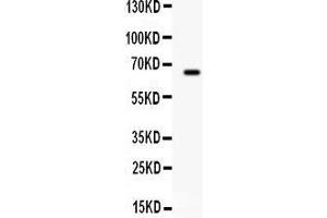 Observed bind size: 66KD (Butyrylcholinesterase antibody  (AA 263-571))