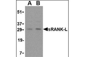 Western blot analysis of sRANK-L in rat liver tissue lysate with this product at (A) 0. (RANKL antibody  (Center))