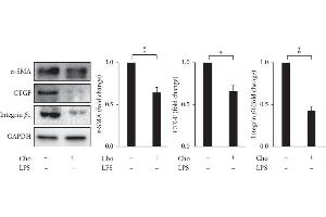 Chrysophanol (Cho) decreased the expression of α-SMA, CTGF, and integrin β-1 in HSC-T6 cells. (Smooth Muscle Actin antibody)