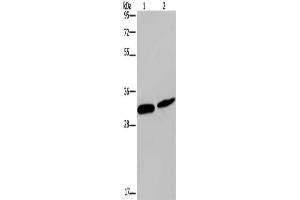 Gel: 10 % SDS-PAGE, Lysate: 40 μg, Lane 1-2: Mouse skin tissue, Hela cells, Primary antibody: ABIN7190808(GJB4 Antibody) at dilution 1/200, Secondary antibody: Goat anti rabbit IgG at 1/8000 dilution, Exposure time: 5 minutes