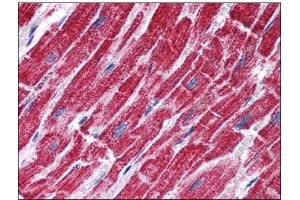 Human Heart: Formalin-Fixed, Paraffin-Embedded (FFPE) (FH antibody  (Internal Region))