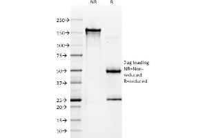 SDS-PAGE Analysis Purified HLA-A Mouse Monoclonal Antibody (108-2C5). (HLA-A antibody)