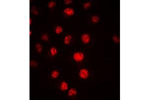 Immunofluorescent analysis of CDC16 staining in HeLa cells. (CDC16 antibody  (C-Term))