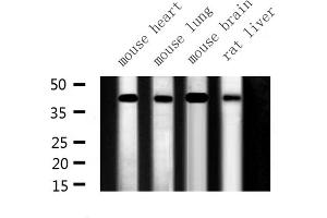 Western blot analysis of ILKAP expression in various lysates