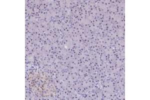 Immunohistochemical staining of human pancreas with C3orf26 polyclonal antibody  shows moderate nucleolar positivity in exocrine glandular cells at 1:200-1:500 dilution. (CMSS1 antibody)