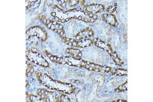 Immunohistochemistry of paraffin-embedded rat kidney using FGD1 antibody (ABIN7267284) at dilution of 1:100 (40x lens). (FGD1 antibody  (AA 700-800))