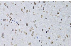 Immunohistochemistry of paraffin-embedded Rat brain using LMNB2 Polyclonal Antibody at dilution of 1:100 (40x lens). (Lamin B2 antibody)