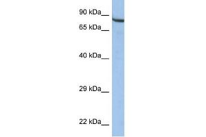 WB Suggested Anti-ZNF630 Antibody Titration:  0. (ZNF630 antibody  (Middle Region))