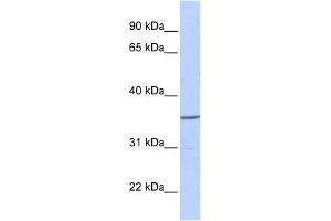 WB Suggested Anti-ZNF688 Antibody Titration:  0.
