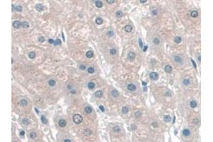 Detection of KATNA1 in Human Liver Tissue using Polyclonal Antibody to Katanin P60 Subunit A 1 (KATNA1) (KATNA1 antibody  (AA 8-229))