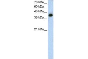 Western Blotting (WB) image for anti-Microtubule Associated Tumor Suppressor 1 (MTUS1) antibody (ABIN2462816) (MTUS1 antibody)