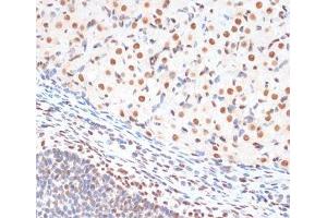 Immunohistochemistry (Paraffin-embedded Sections) (IHC (p)) image for anti-Tumor Protein P53 (TP53) (pSer33) antibody (ABIN7265276)