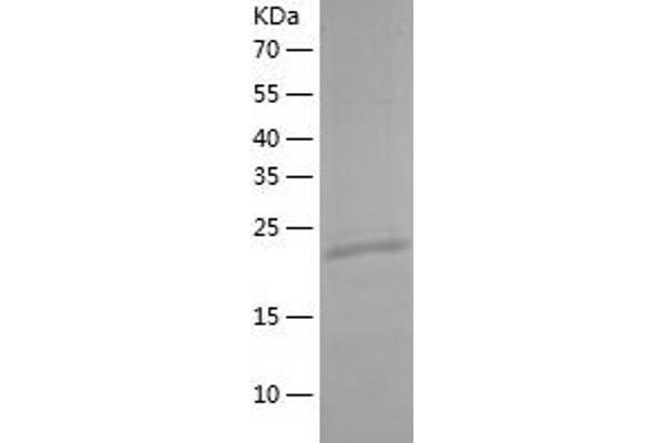 MOBKL2B Protein (AA 1-216) (His tag)