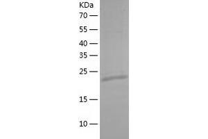 Western Blotting (WB) image for MOB Kinase Activator 3B (MOB3B) (AA 1-216) protein (His tag) (ABIN7124010)