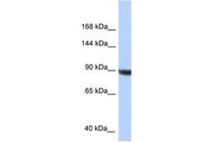 Image no. 1 for anti-KIAA1549 (KIAA1549) (C-Term) antibody (ABIN6747731) (KIAA1549 antibody  (C-Term))