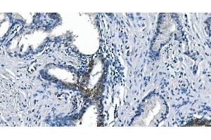 IHC analysis of ASS1 using anti-ASS1 antibody (ABIN7601192).