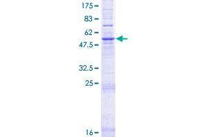 ELOVL2 Protein (AA 1-296) (GST tag)