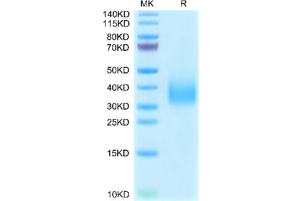 TREM2 Protein (AA 19-174) (His tag)