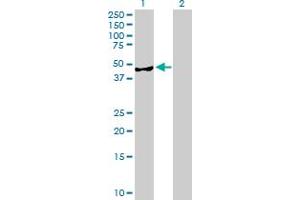 Western Blot analysis of AMDHD2 expression in transfected 293T cell line by AMDHD2 MaxPab polyclonal antibody. (AMDHD2 antibody  (AA 1-439))