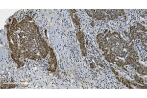 IHC analysis of PARP using anti-PARP antibody (ABIN7602277).