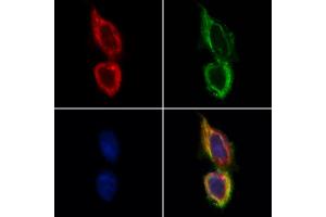 ABIN6265766 and ABIN6268647 staining Hela by IF/ICC. (TSC1 antibody  (C-Term))