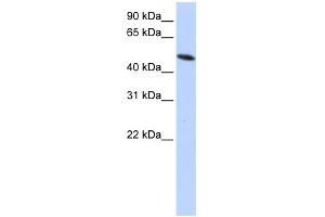 WB Suggested Anti-PDIA6 Antibody Titration: 0. (PDIA6 antibody  (Middle Region))