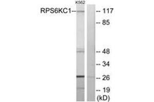Western blot analysis of extracts from K562 cells, using RPS6KC1 Antibody. (RPS6KC1 antibody  (AA 231-280))