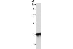Gel: 10 % SDS-PAGE, Lysate: 40 μg, Lane: MCF7 cells, Primary antibody: ABIN7131160(SPATA2L Antibody) at dilution 1/500, Secondary antibody: Goat anti rabbit IgG at 1/8000 dilution, Exposure time: 30 seconds (SPATA2L antibody)