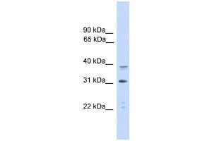 WB Suggested Anti-CEBPA Antibody Titration: 0. (CEBPA antibody  (C-Term))