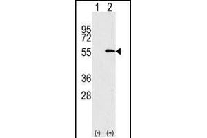 Western blot analysis of NUP50 (arrow) using rabbit polyclonal NUP50 Antibody (C-term) (R). (NUP50 antibody  (C-Term))