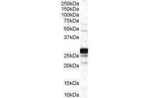 Western Blotting (WB) image for anti-Catechol-O-Methyltransferase (COMT) (Internal Region) antibody (ABIN2465545) (COMT antibody  (Internal Region))