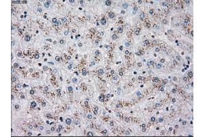 Immunohistochemical staining of paraffin-embedded liver tissue using anti-CHEK2mouse monoclonal antibody. (CHEK2 antibody)