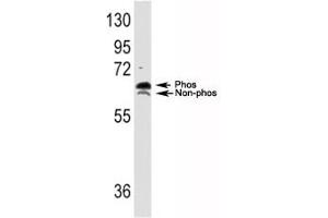 Western Blotting (WB) image for anti-Ribosomal Protein S6 Kinase, 70kDa, Polypeptide 1 (RPS6KB1) (AA 425-454) antibody (ABIN3032481)