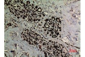 Immunohistochemistry (IHC) image for anti-Apurinic/Apyrimidinic Endonuclease 1 (APEX1) (acLys6) antibody (ABIN3181880)