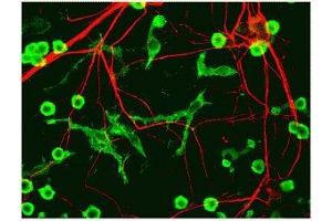 Immunostaining of cultured neurons and glia showing specific labeling of neuronal processes (red) using our alpha-internexin antibody and microglia (green) with a coronin 1a antibody. (INA antibody)