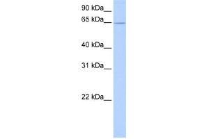 WB Suggested Anti-ZNF526 Antibody Titration:  0.