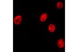 ABIN6275072 staining HepG2 by IF/ICC. (POLR2J antibody  (N-Term))