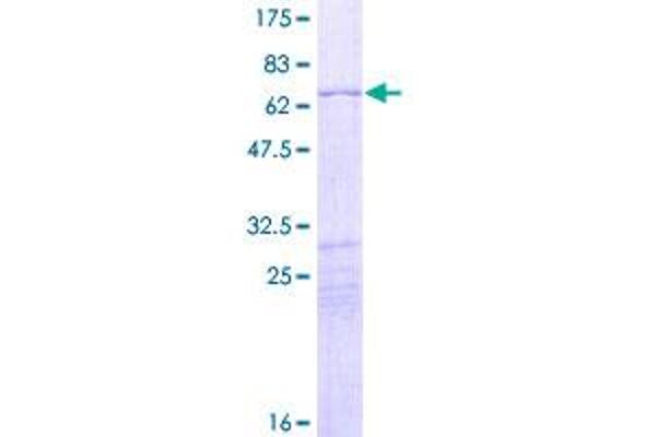 HOXD10 Protein (AA 1-340) (GST tag)