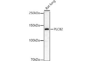 Western blot analysis of extracts of Rat lung, using PLCB2 antibody (ABIN6133052, ABIN6145747, ABIN6145748 and ABIN6224164) at 1:1000 dilution. (Phospholipase C beta 2 antibody  (AA 1-199))
