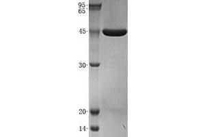 Validation with Western Blot (Carboxypeptidase A2 Protein (His tag))