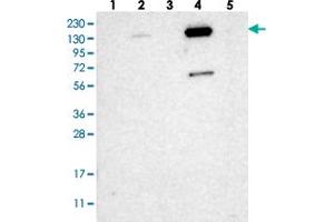 Western blot analysis of Lane 1: RT-4, Lane 2: U-251 MG, Lane 3: Human Plasma, Lane 4: Liver, Lane 5: Tonsil with ZNF629 polyclonal antibody  at 1:250-1:500 dilution.