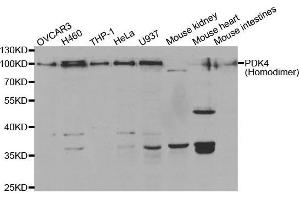 Western Blotting (WB) image for anti-Pyruvate Dehydrogenase Kinase, Isozyme 4 (PDK4) antibody (ABIN6220032) (PDK4 antibody)