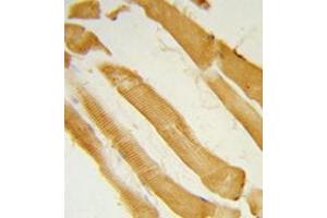 Formalin-fixed and paraffin-embedded human skeletal muscle reacted with ITPKC Antibody (N-term) followed which was peroxidase-conjugated to the secondary antibody, followed by DAB staining. (ITPKC antibody  (N-Term))