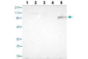 Western blot analysis of Lane 1: RT-4 cell line, Lane 2: U-251MG sp cell line, Lane 3: A-431 cell line, Lane 4: human liver tissue, and Lane 5: human tonsil tissue with BTK polyclonal antibody . (BTK antibody  (AA 63-198))