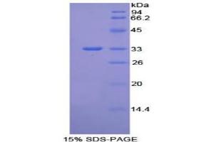 SDS-PAGE analysis of Mouse Integrin beta 1 Protein.