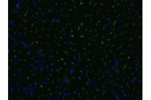 Immunocytochemistry staining of an infarcted porcine heart with anti-CD105 (MEM-229, green), cell nuclei stained with DAPI (blue). (Endoglin antibody)
