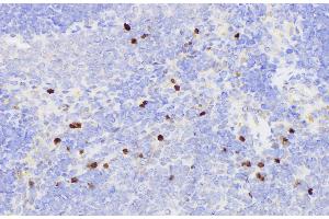 Immunohistochemistry of paraffin-embedded Rat spleen using SERPINB2 Polycloanl Antibody at dilution of 1:200 (SERPINB2 antibody)